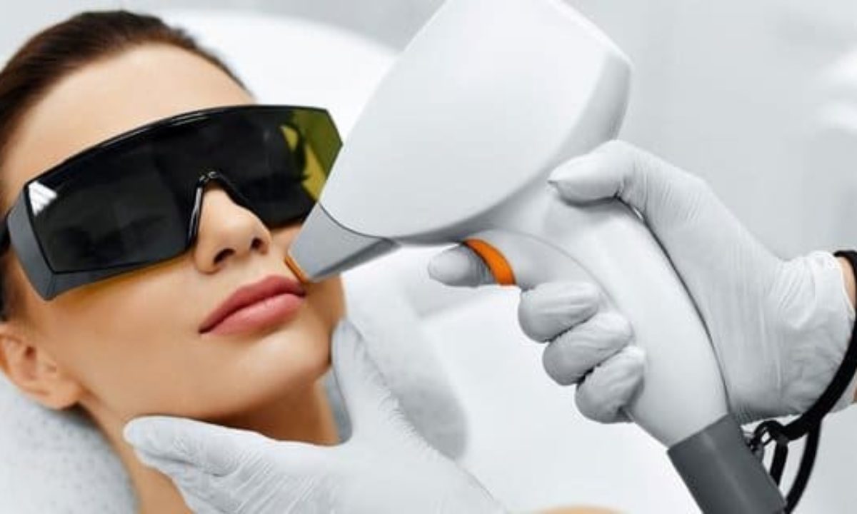 Lasers and What They Can Do For Your Face Cosmetic Laser