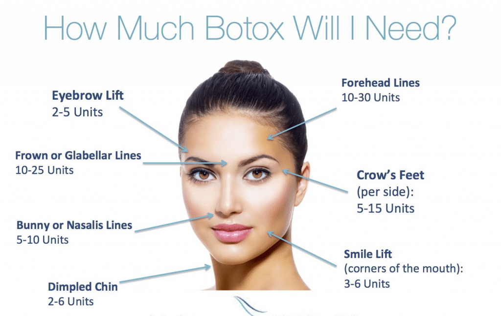 BOTOX® Treatment Near Me HowMuchBotoxwillINeed-44b7a611.jpg-1024x647