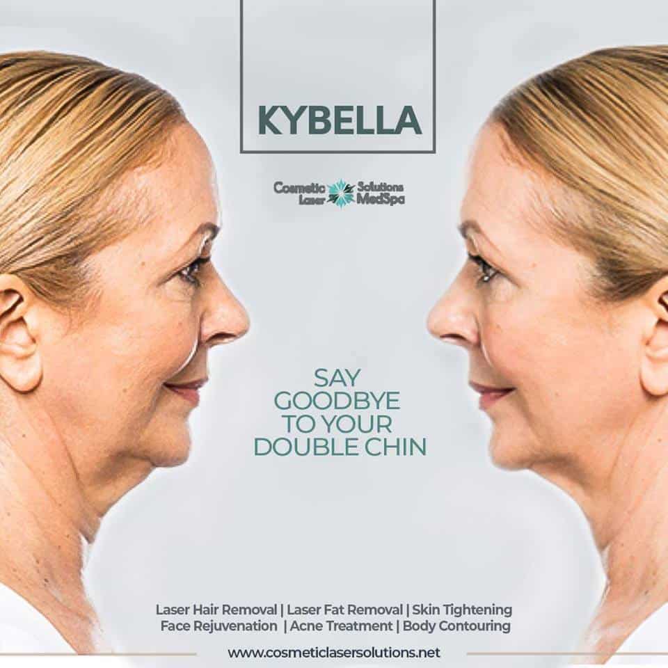 Kybella for a Chiseled Jawline, Utah Facial Plastics